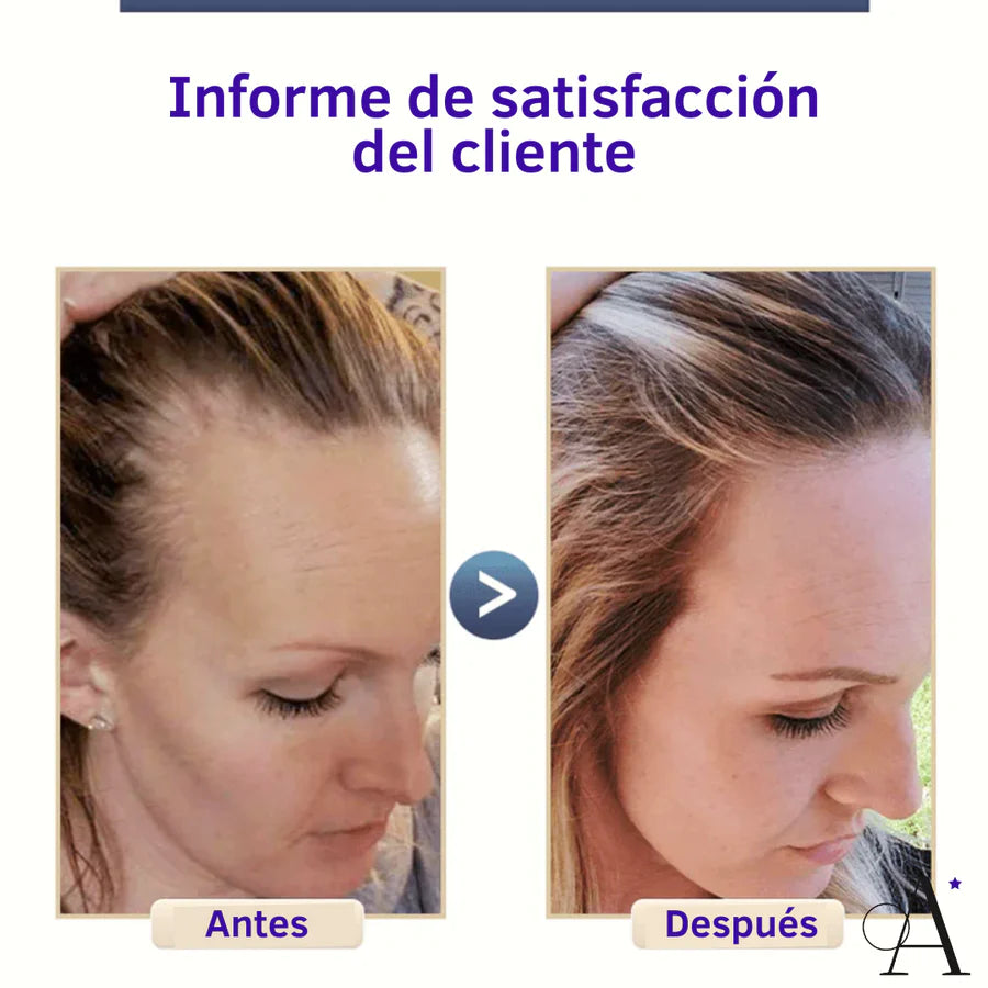 Shampoo de arroz anticaída en barra Glam by SK ǀ Tienda de Belleza