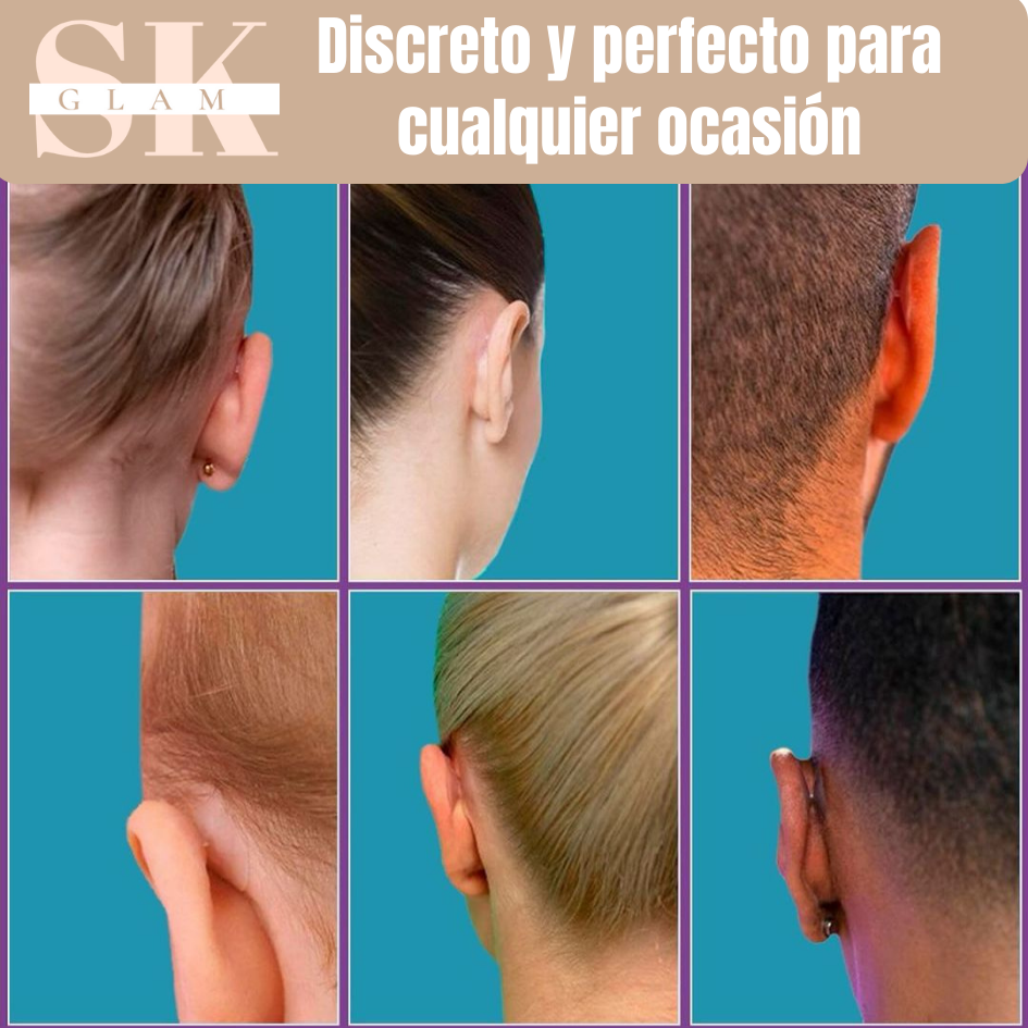 EarFix® - Sticker Corrector de orejas 👂 X 8 UNIDADES – Glam by SK ǀ ...